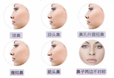 线雕隆鼻和玻尿酸区别