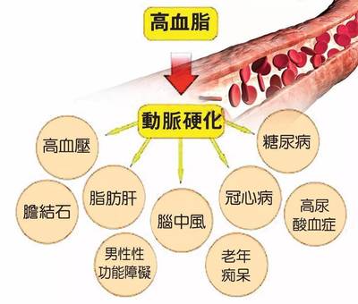 怎么能知道胆固醇高