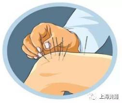 膝盖积液中医怎么治疗
