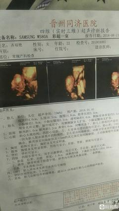 怀孕6个多月胎动少正常吗
