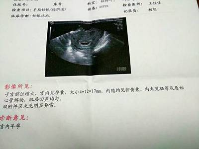 两个月没有胎心