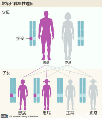 染色体会影响怀孕吗