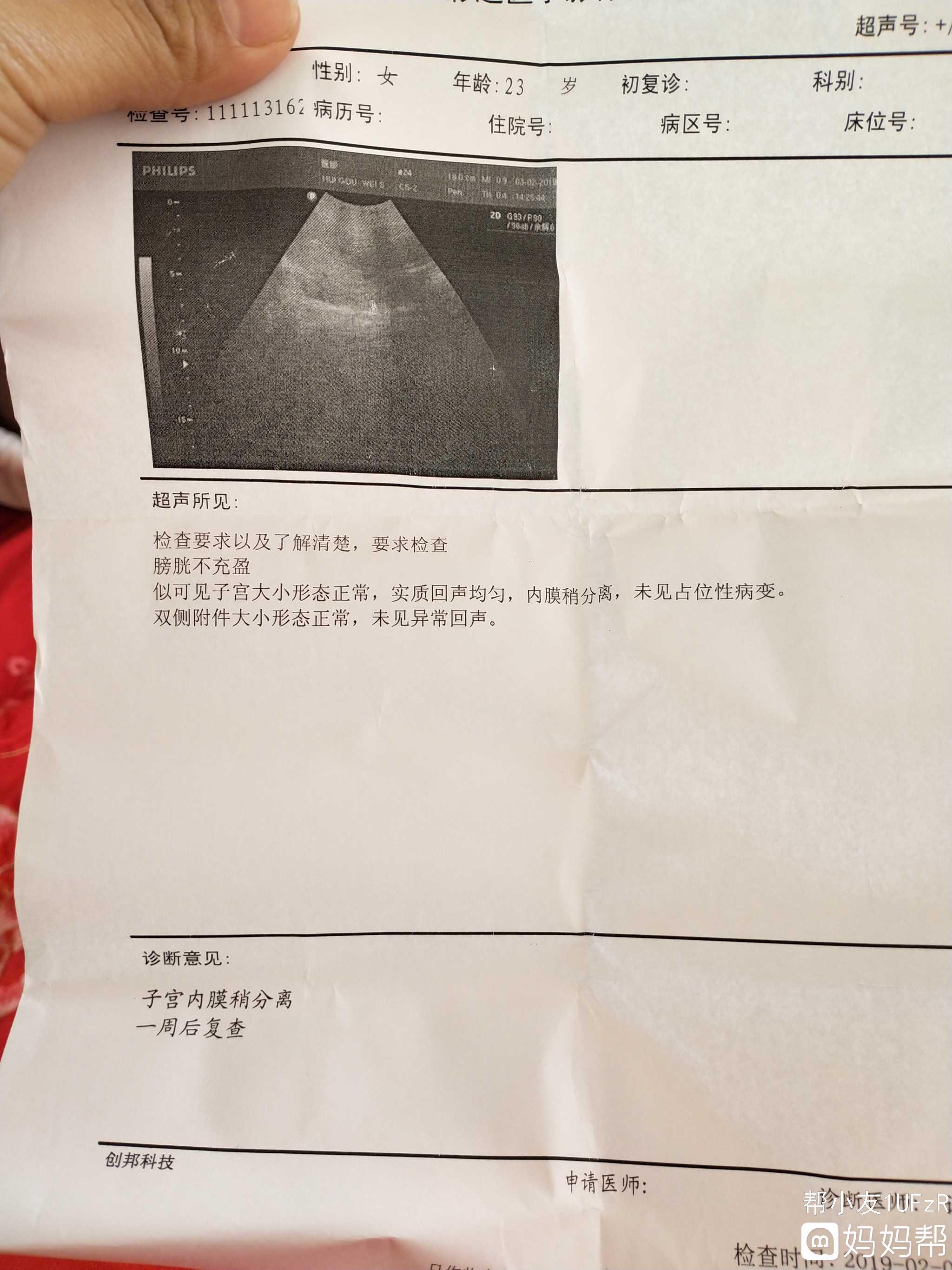 怀孕四个半月胎儿有多大