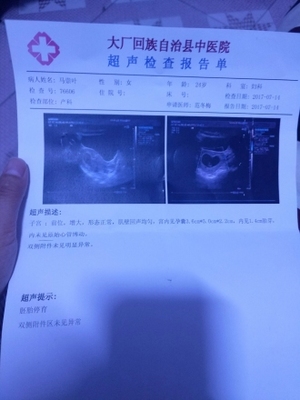 怀孕七周的症状和表现
