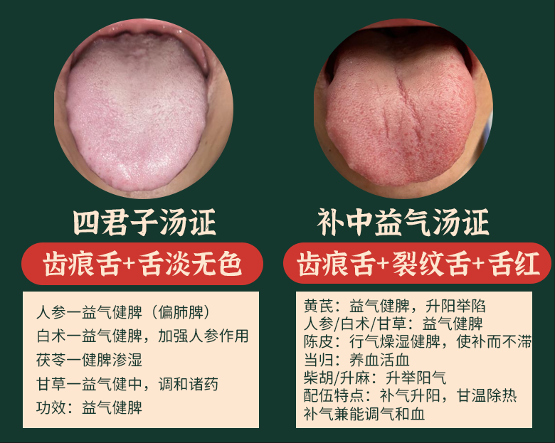 舌尖裂纹是怎么回事
