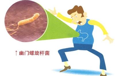 螺杆菌怎么治疗