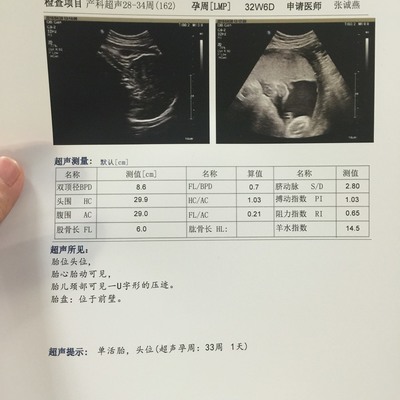 孕多少周转头位