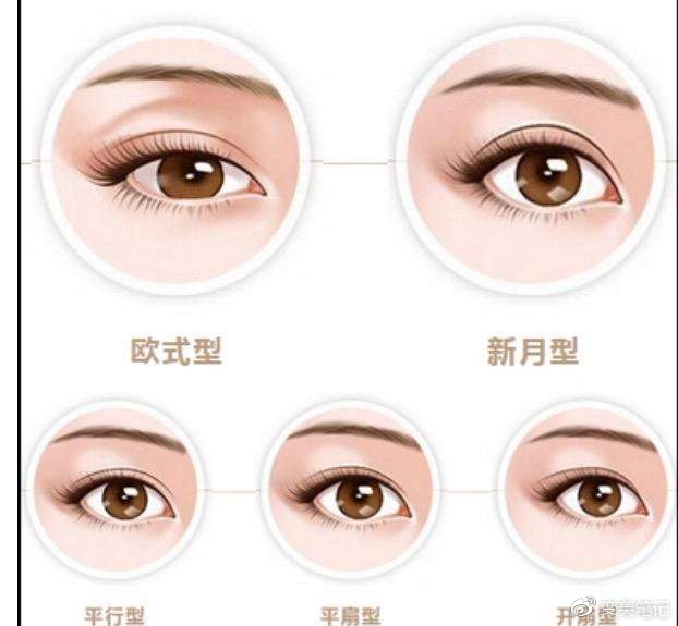 做双眼皮的形状