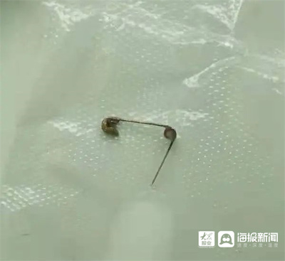 一个月的婴儿嗓子有痰怎么办