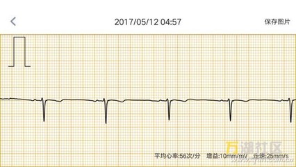 一天心脏跳动多少正常