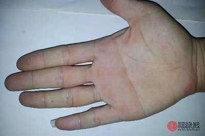 男人双手断掌命运详解