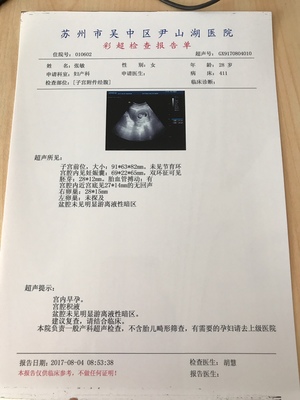 宫腔积液能怀孕吗