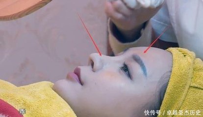 去美容院针清痘好不好