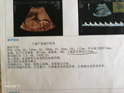 18周胎儿真实图