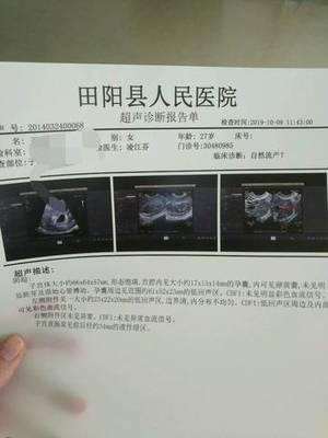 怀孕前会出血吗