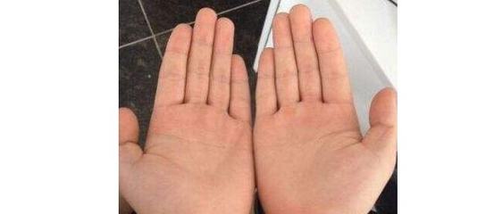 男人双手断掌命运详解