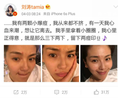 痘痘不挤会有黑色的印