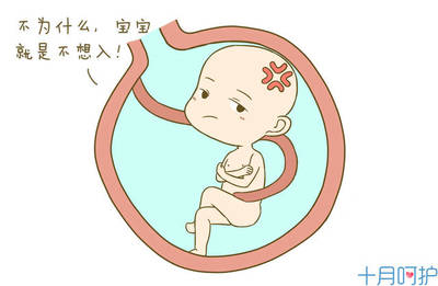 怎样判断胎儿是否入盆