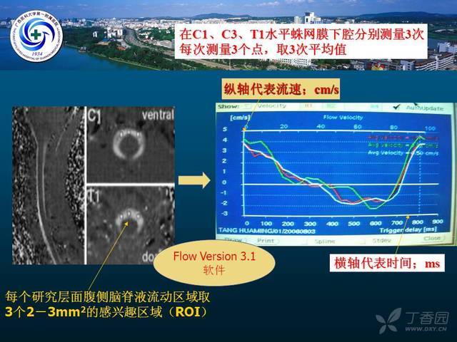 变频器op2是什么故障