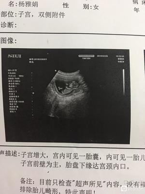 怀孕甲状腺检查