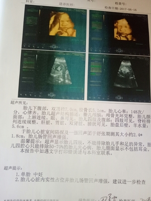 六个月胎儿双顶径标准