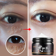什么牌子眼霜去黑眼圈眼袋效果好