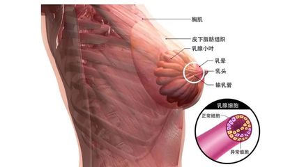 乳腺扩张是怎么回事