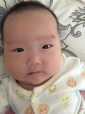 痘痘是疮吗