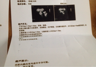 卵泡长不大会怀孕吗
