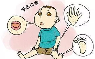儿童手足口病怎么治疗