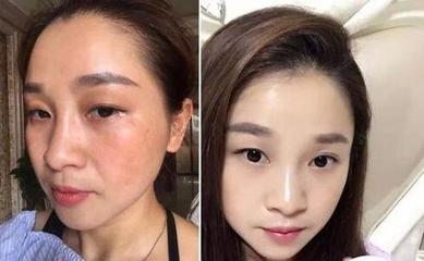 25岁学美容晚不晚
