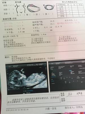 怀孕能吃鸟肉吗