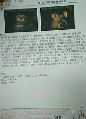 单肾宝宝