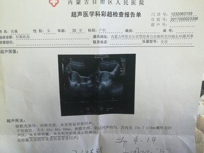怀孕四十天需要做什么检查