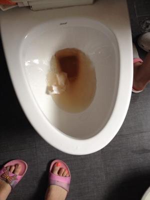 小便发浑是怎么回事