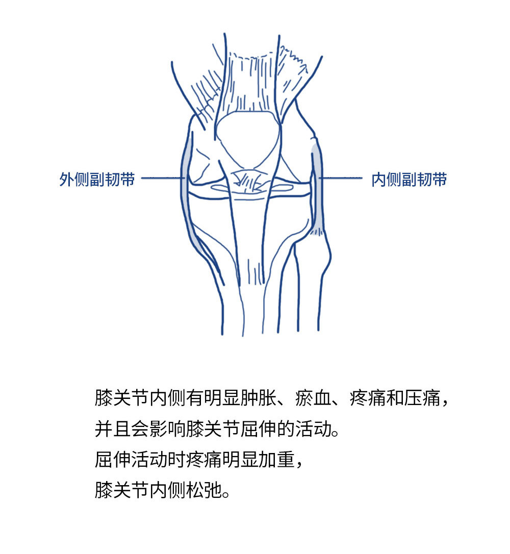 打完篮球膝盖疼是怎么回事