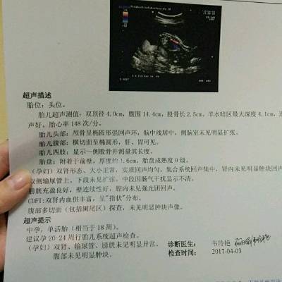 怀孕18周胎儿稳定了吗