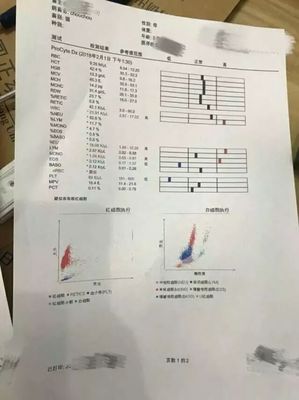 新生儿血小板偏低