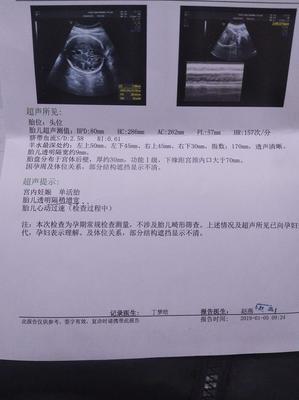 两个月胎儿真实图片