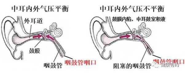 中耳炎会引起咳嗽吗