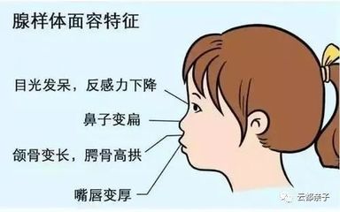 宝宝腺体肥大