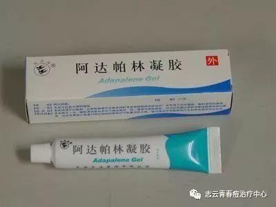 粉刺用什么药膏