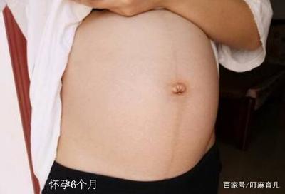 压孕妇肚子