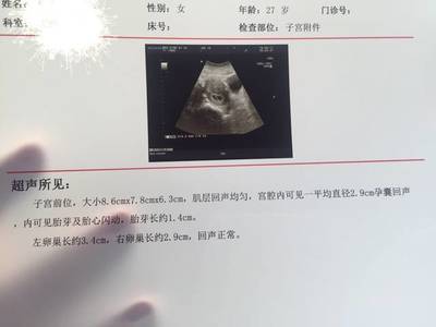 怀孕50天有胎心吗