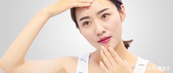 长痘痘吃什么会留痘印