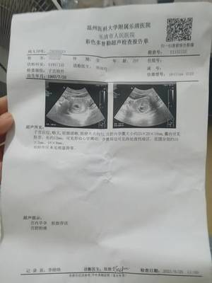 怀孕会出血嘛