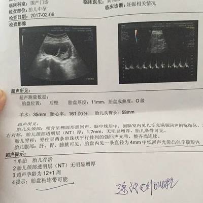 怀孕六个月胎儿有几斤