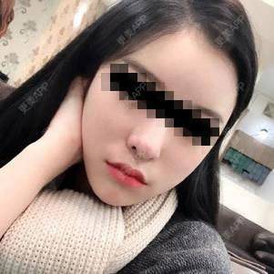 为什么脸的边缘长痘痘