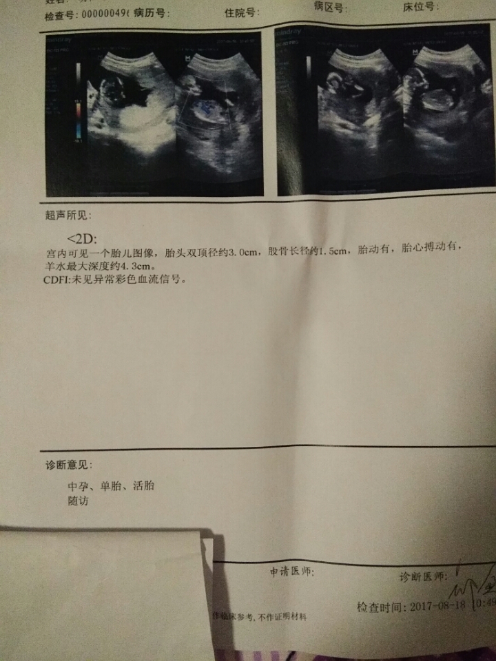 怀孕四个半月胎儿有多大