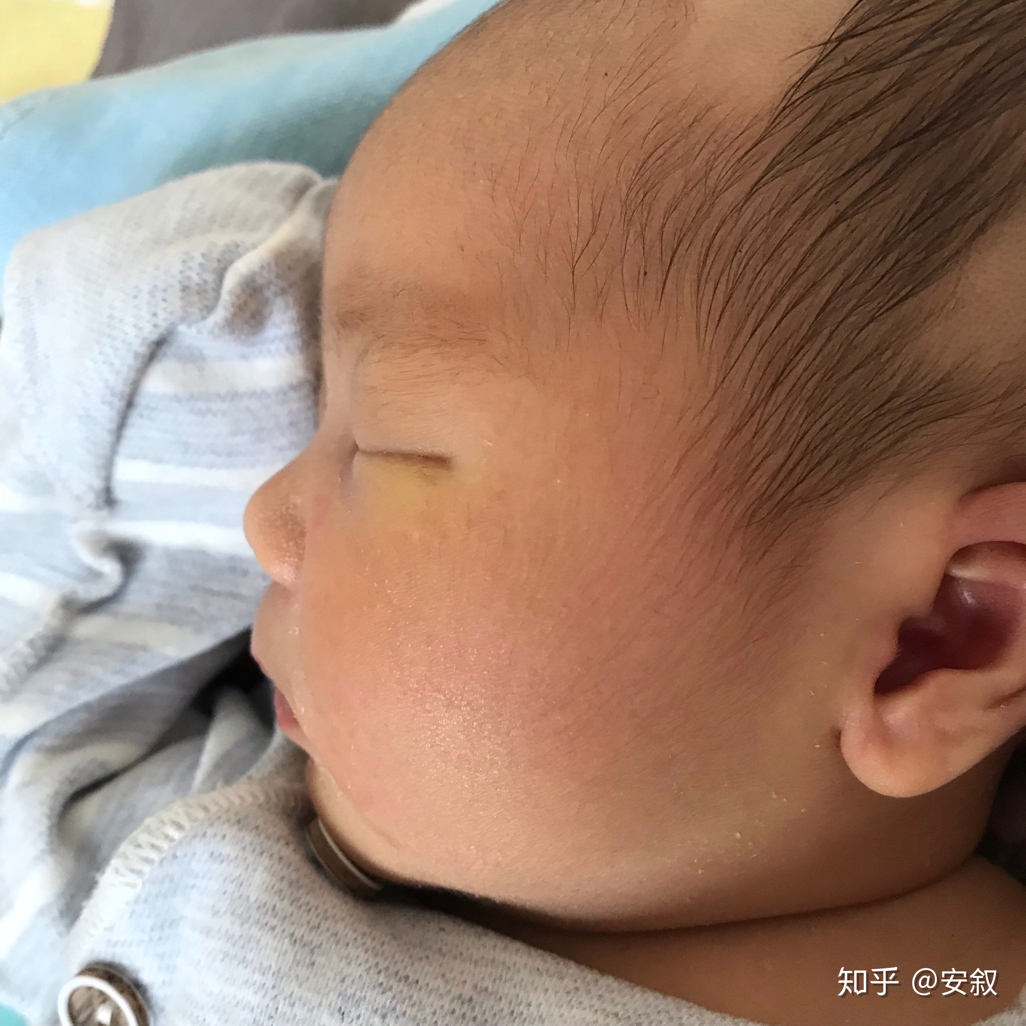 婴儿几个月头定型
